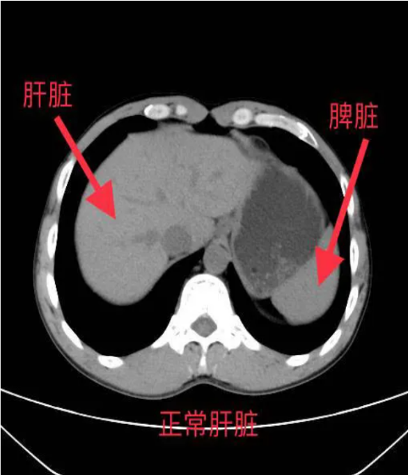 图片1.png 图片1.png